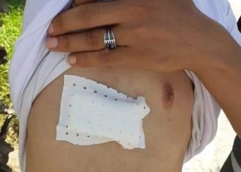 معطلو جرسيف يستنكرون استعمال القوة ضدهم ويطالبون بفتح تحقيق في الاعتداء عليهم