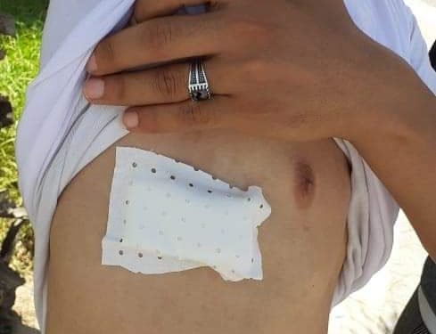 معطلو جرسيف يستنكرون استعمال القوة ضدهم ويطالبون بفتح تحقيق في الاعتداء عليهم