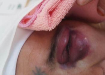 مطالب حقوقية بالتحقيق في تعنيف رجال سلطة لسيدة بالعيون الشرقية