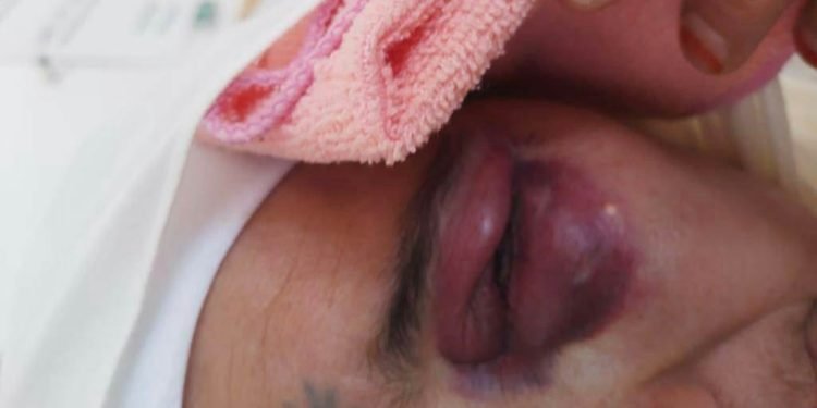 مطالب حقوقية بالتحقيق في تعنيف رجال سلطة لسيدة بالعيون الشرقية