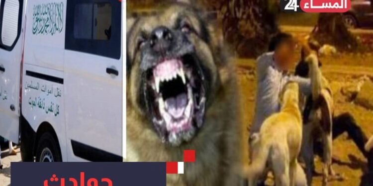 مصرع طفلين بسبب عضة كلب مسعور بالقنيطرة